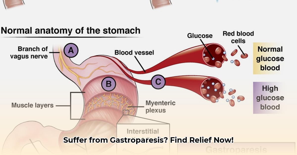 gastroparese